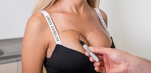 Breast surgery